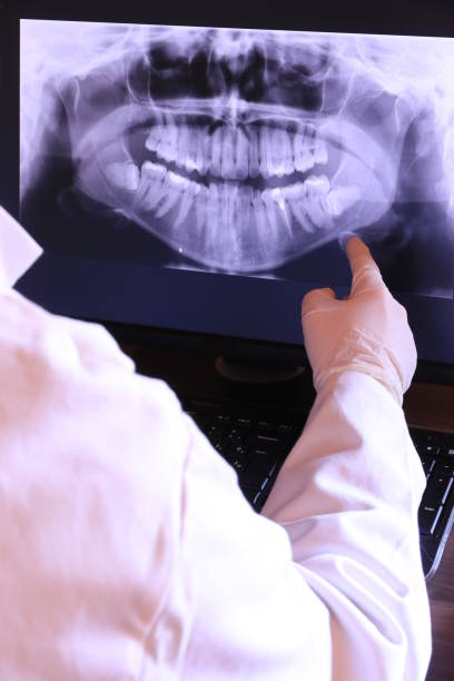 Best Same-Day Emergency Dentist in Milledgeville, GA