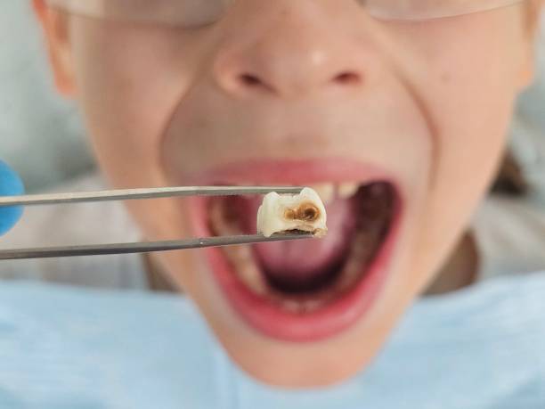 Best Walk-In Emergency Dentist in Milledgeville, GA